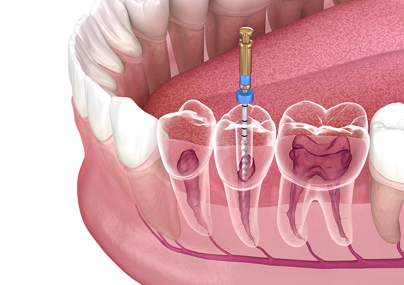 Vadanam Dental Clinic Hyderabad